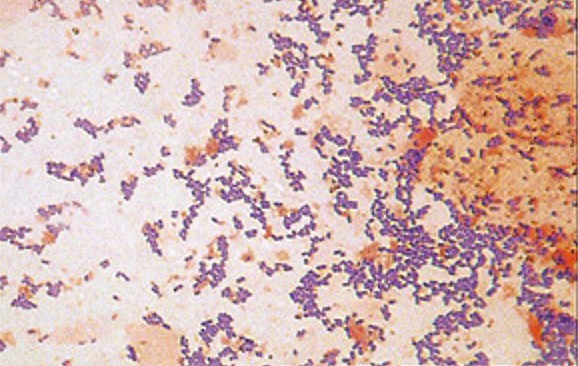 Gram positive rods